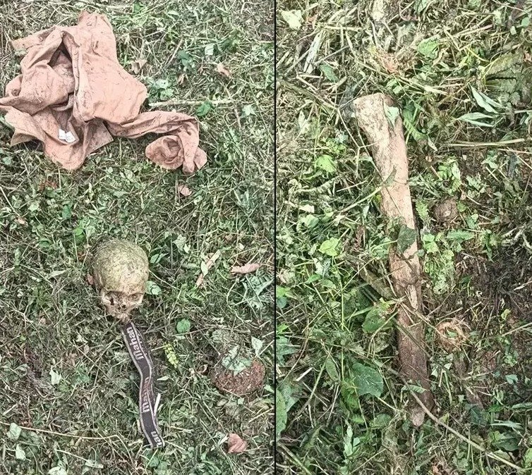 ಬೆಳ್ತಂಗಡಿ: ಕೃಷಿ ತೋಟದಲ್ಲಿ ಅಪರಿಚಿತ ವ್ಯಕ್ತಿಯ ಅಸ್ಥಿಪಂಜರ ಪತ್ತೆ!!